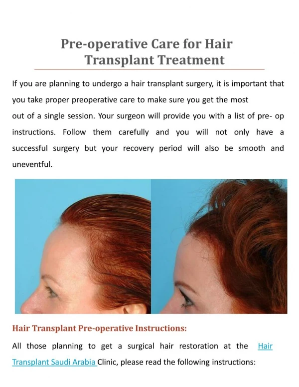 Pre-operative Care for Hair Transplant Treatment Saudi Arabi