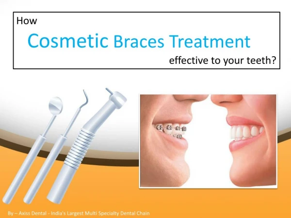 How is Cosmetic Braces treatment effective to your teeth?