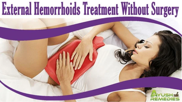 External Hemorrhoids Treatment Without Surgery At Home