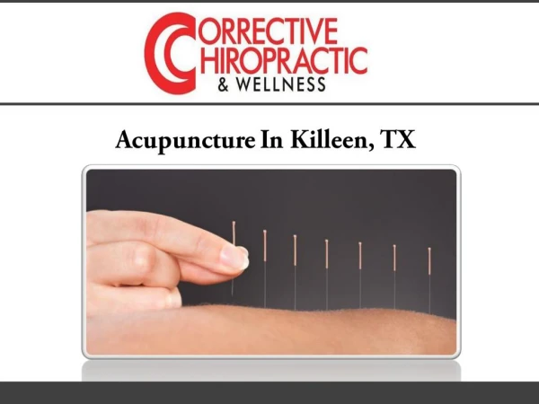 Acupuncture In Killeen, TX