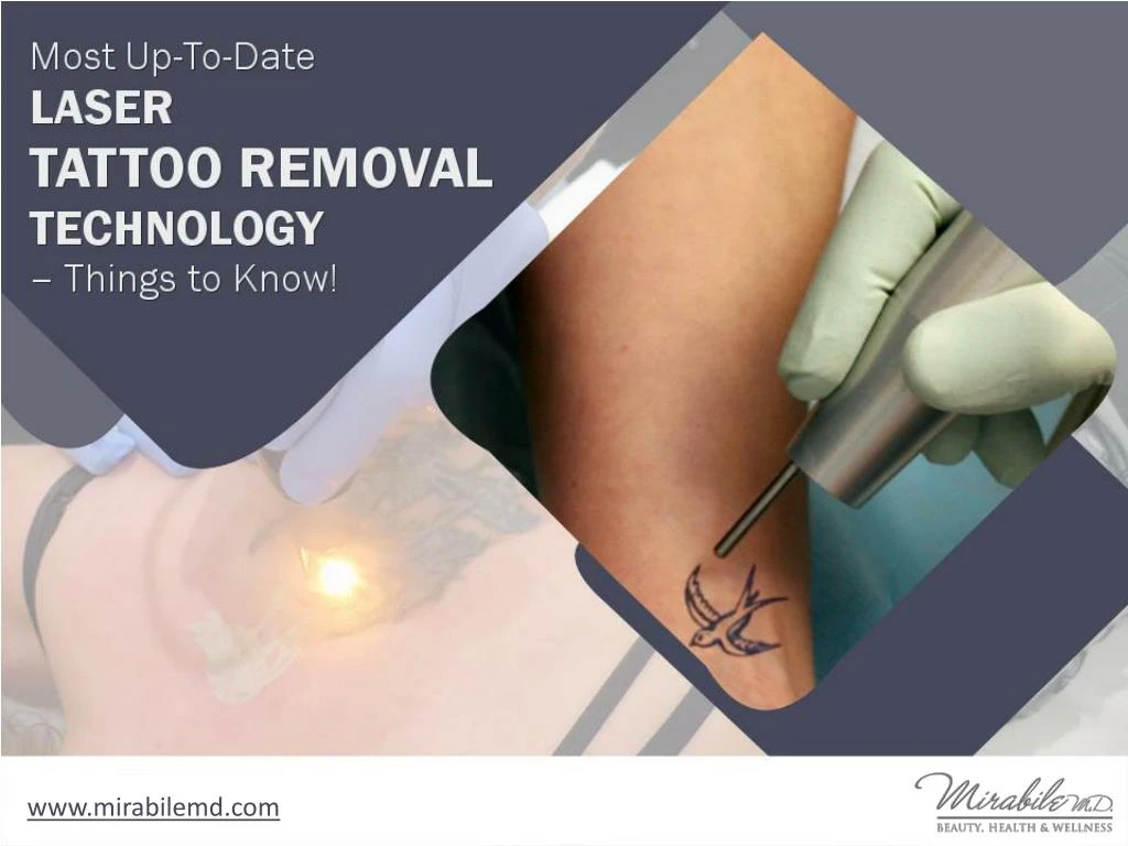 most up to date laser tattoo removal technology things to know