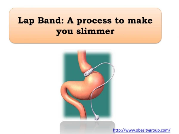 Lap Band: A process to make you slimmer