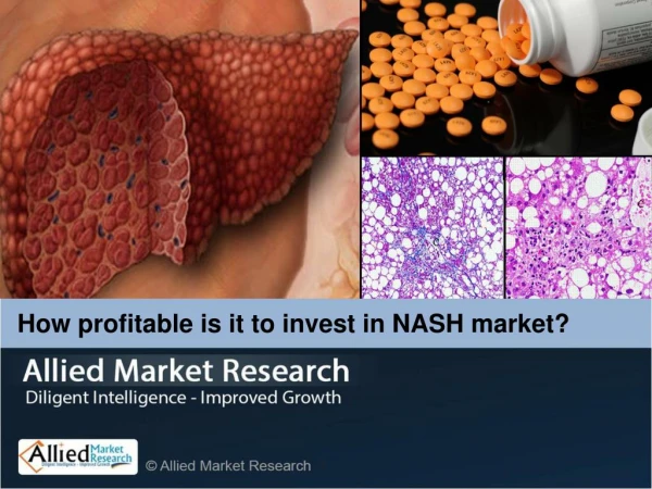 Nonalcoholic Steatohepatitis (NASH) Market
