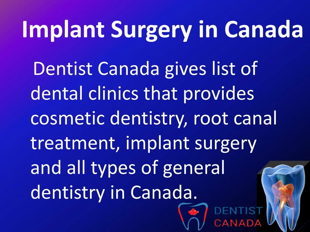 implant surgery in canada