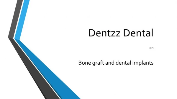 Dentzz Dental on dental implants and bone graft