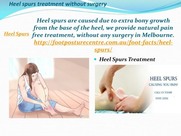Heel spurs treatment without surgery