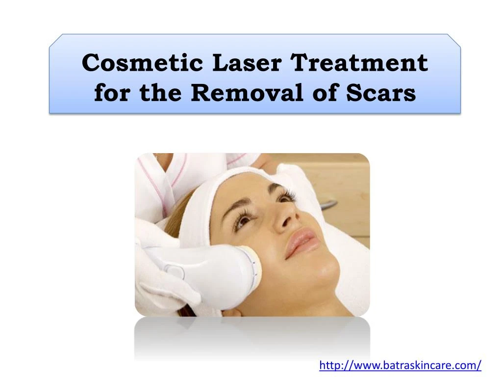cosmetic laser treatment for the removal of scars