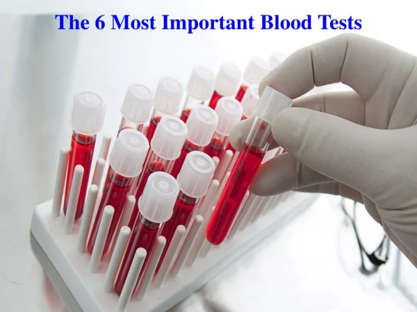 The 6 Most Important Blood Tests