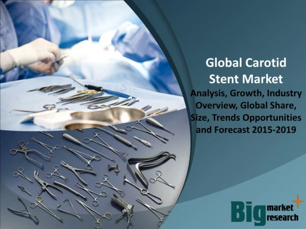 Global Carotid Stent Market 2015 - Size, Share, Growth & Forecast 2019