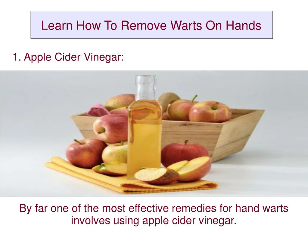by far one of the most effective remedies for hand warts involves using apple cider vinegar