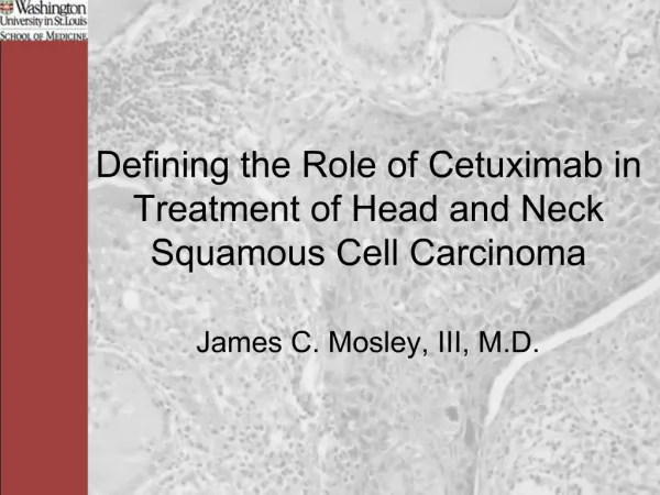 Defining the Role of Cetuximab in Treatment of Head and Neck Squamous Cell Carcinoma