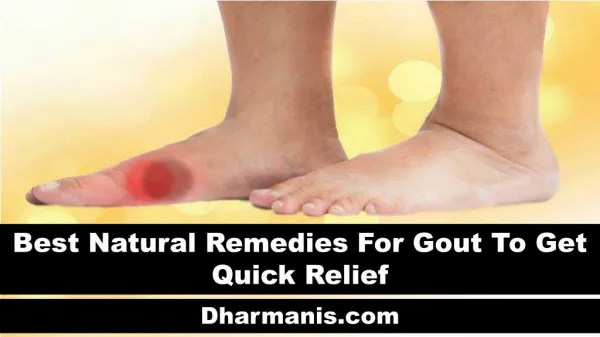 Best Natural Remedies For Gout To Get Quick Relief
