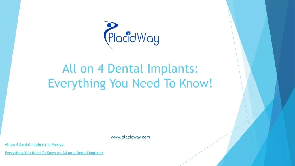 all on 4 dental implants everything you need to know