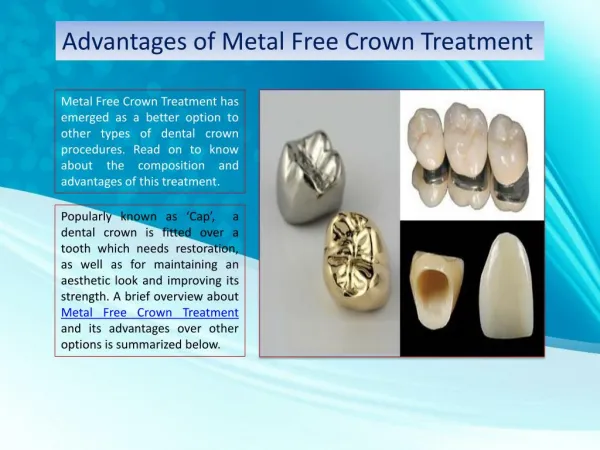 Advantages of Metal Free Crown Treatment