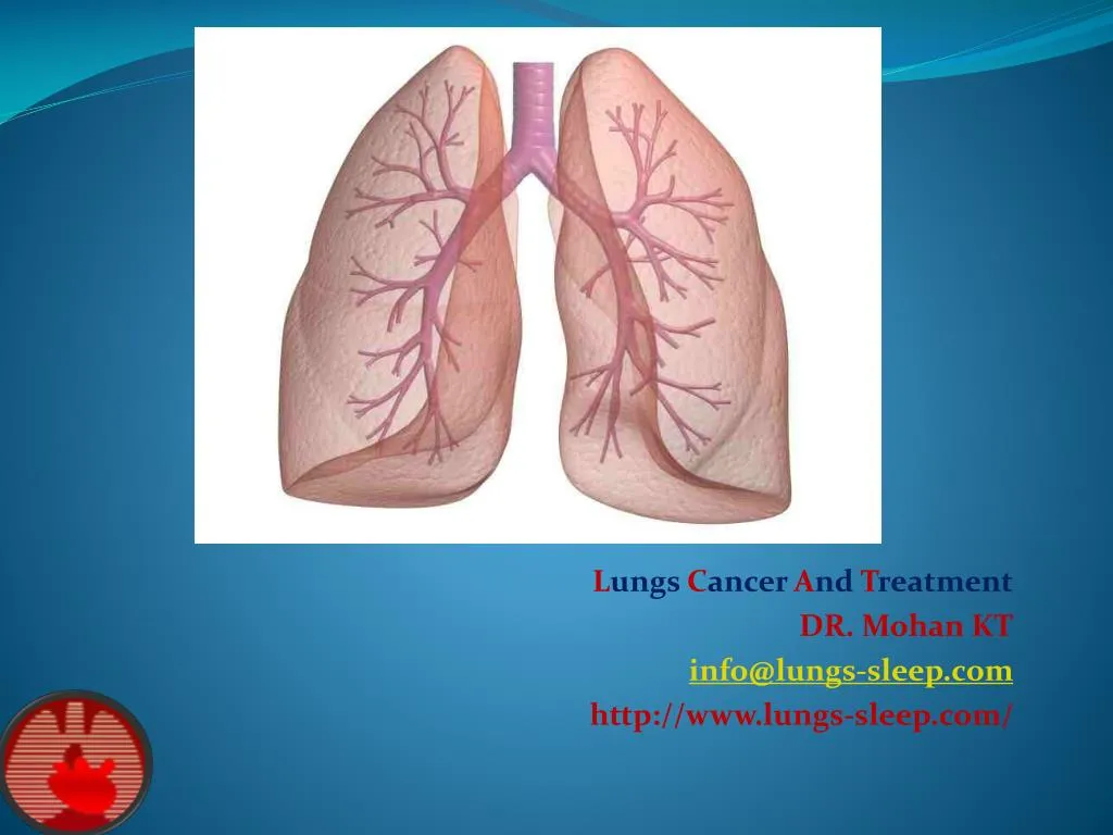 l ungs c ancer a nd t reatment dr mohan kt info@lungs sleep com http www lungs sleep com