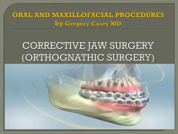 Corrective Jaw Surgery by Dr. Gregory Casey