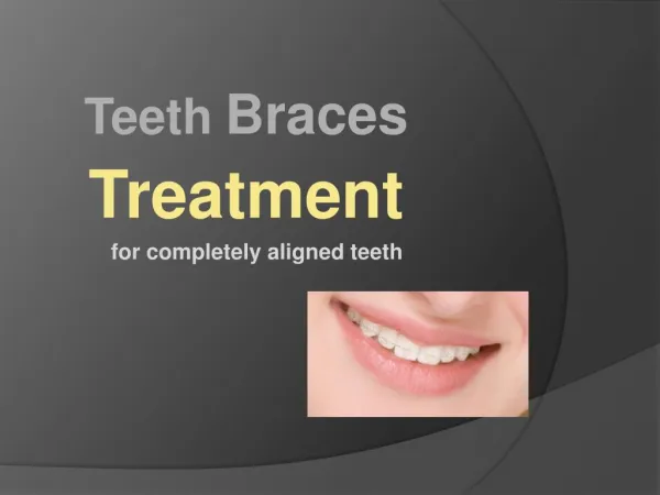 Teeth braces treatment for completely aligned teeth