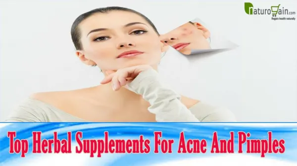 Top Herbal Supplements For Acne And Pimples That You Should Not Miss