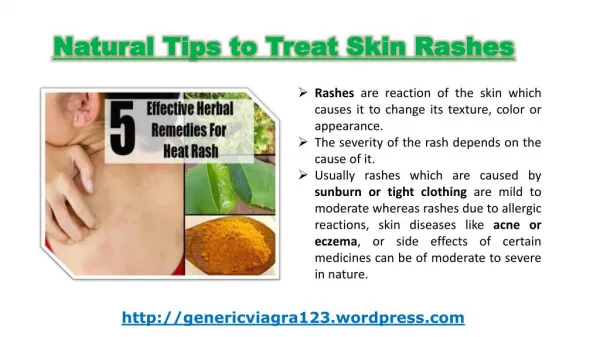 Natural Tips to Treat Skin Rashes
