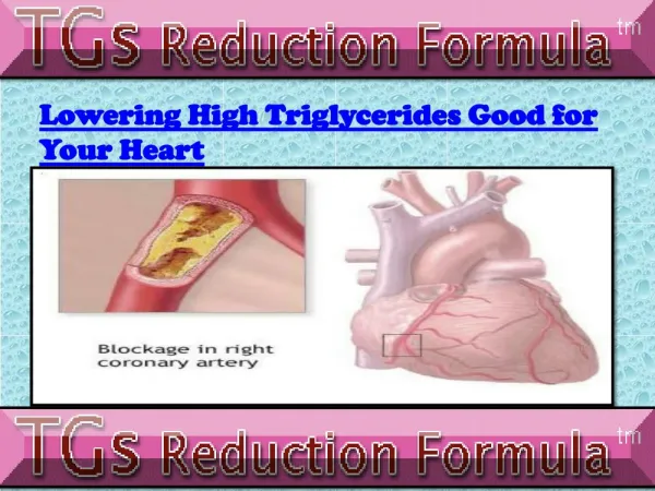 Lowering High Triglycerides for Heart