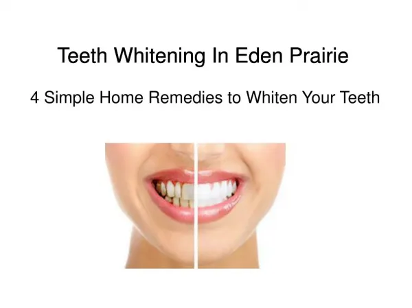 Teeth Whitening In Eden Prairie