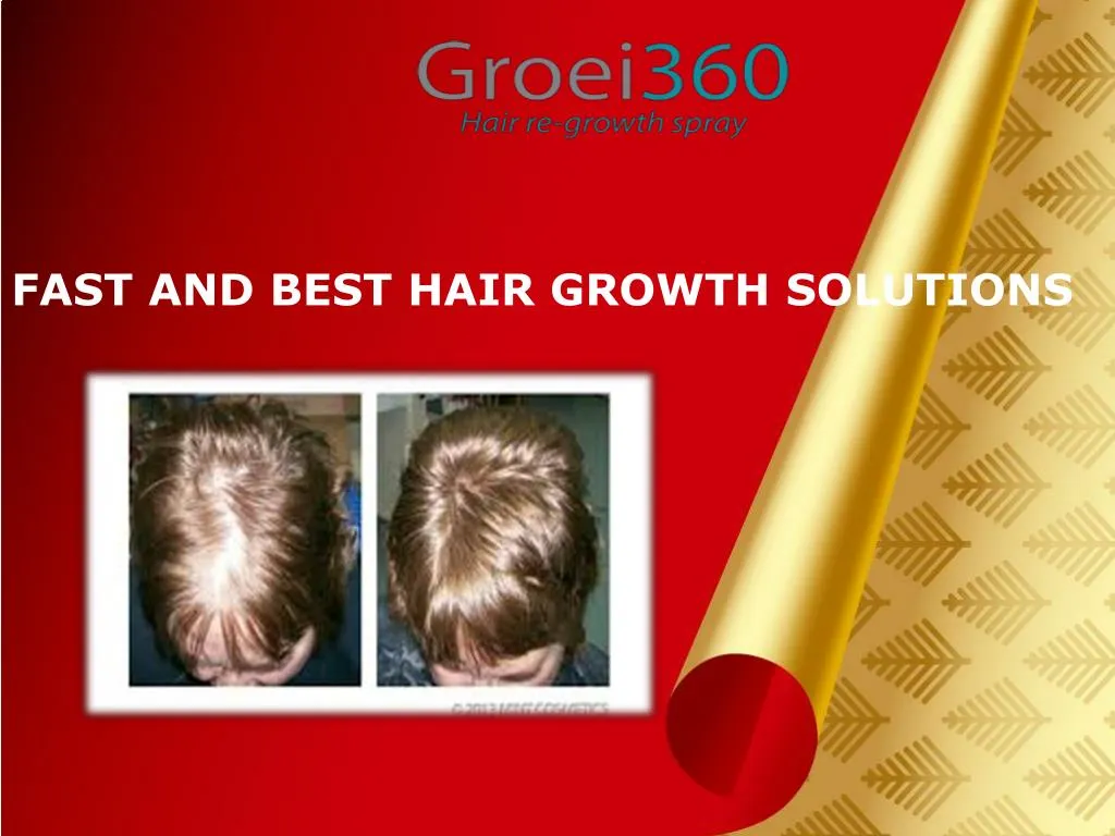 fast and best hair growth solutions