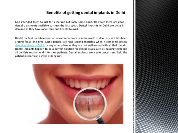 Benefits of getting dental implants in Delhi