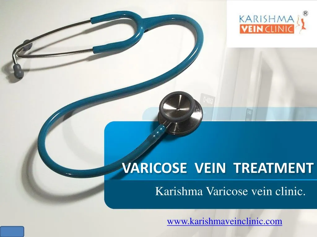 varicose vein treatment