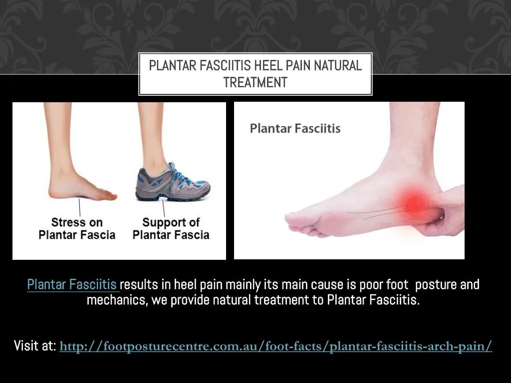 plantar fasciitis heel pain natural treatment