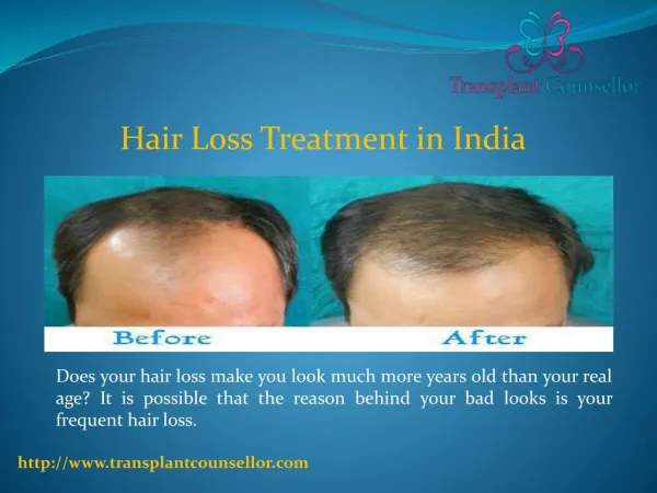 Hair Loss Treatment in India