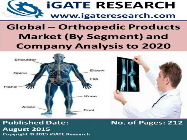 Global - Orthopedic Products Market (By Segment) and Company Analysis to 2020