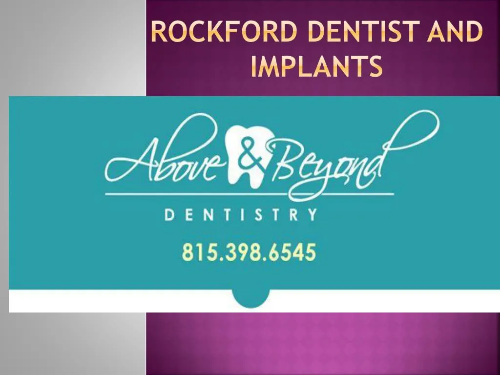 rockford dentist and implants
