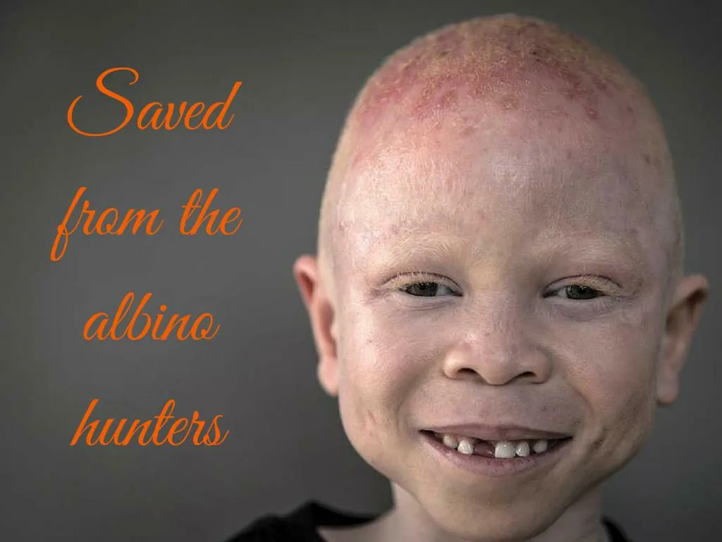 saved from the albino hunters