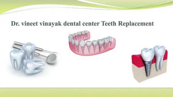 Dr vineet vinayak dental center Teeth Replacement Options