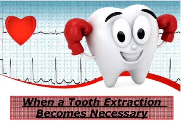 When a Tooth Extraction Becomes Necessary