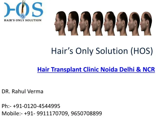 Special Offer on FUE Hair Transplant get hair transplant @ Rs 15/Graft