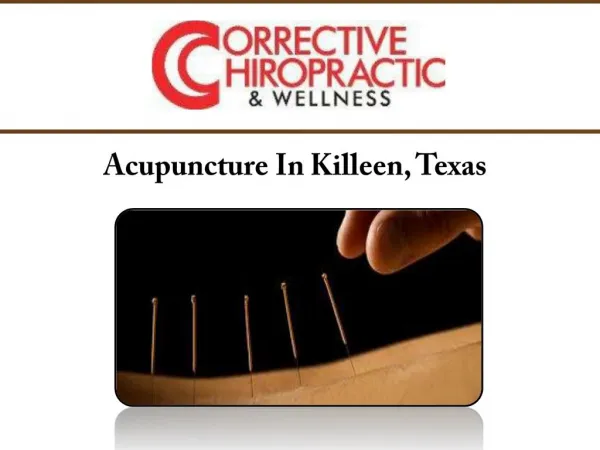 Acupuncture In Killeen, Texas
