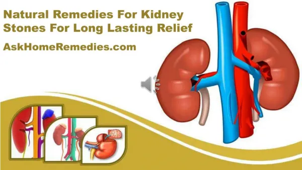 Natural Remedies For Kidney Stones For Long Lasting Relief