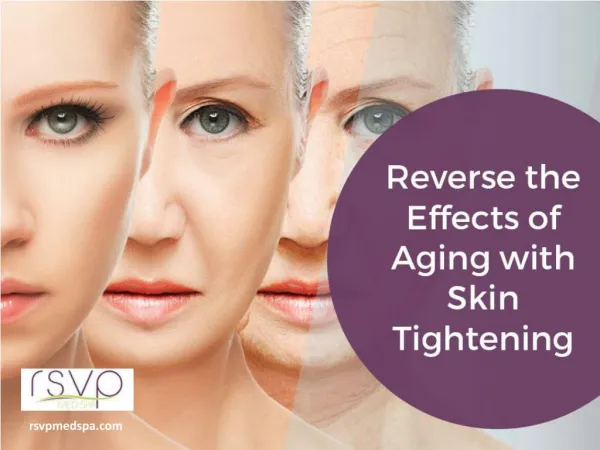 Benefits of Skin Tightening