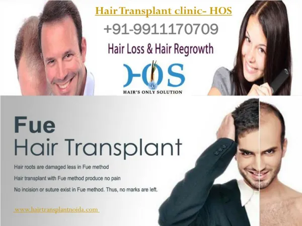 Hair Transplant clinic- HOS 9911170709