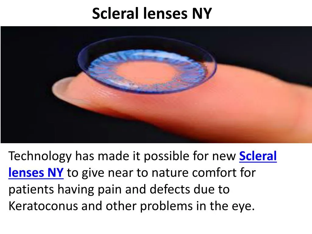scleral lenses ny