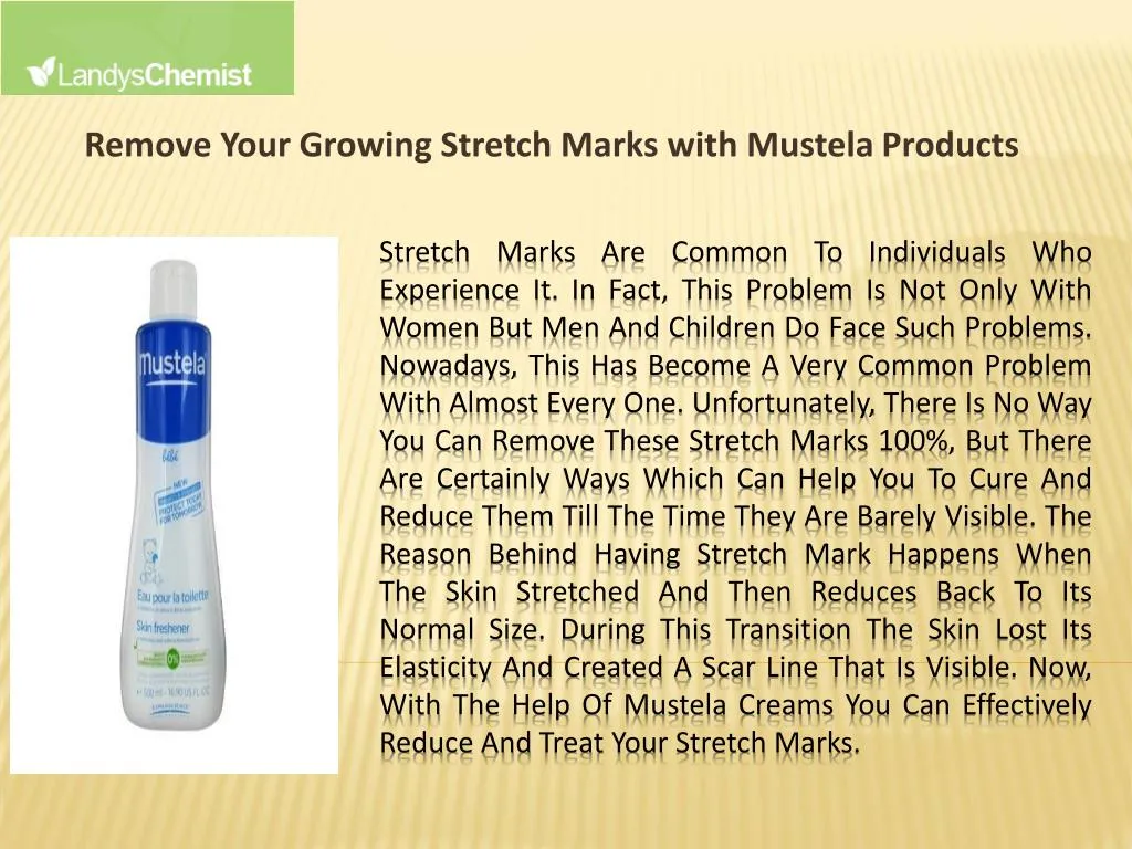 remove your growing stretch marks with mustela products