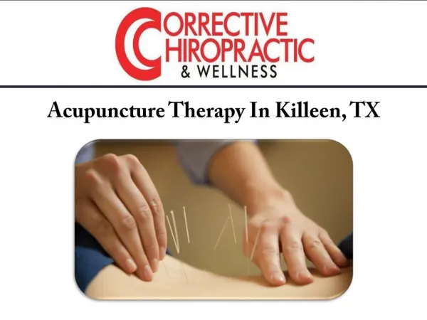 Acupuncture Therapy In Killeen, TX
