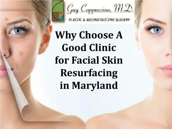 Why Choose A Good Clinic for Facial Skin Resurfacing in Maryland