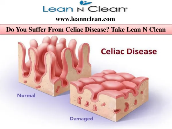 Do You Suffer From Celiac Disease? Take Lean N Clean