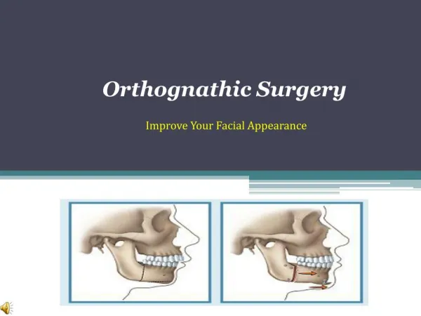 What is Orthognathic Surgery
