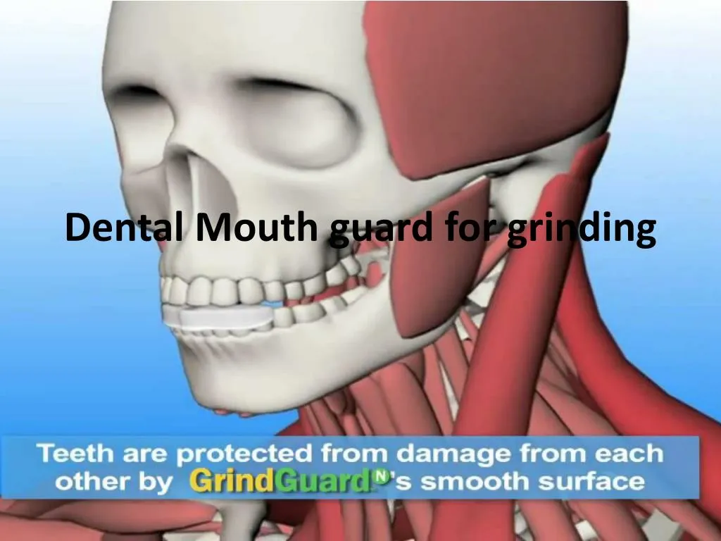 dental mouth guard for grinding