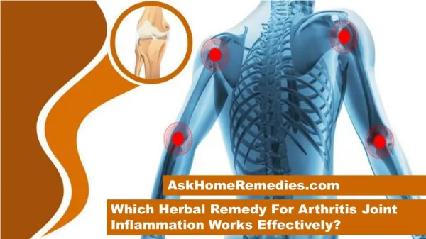 Which Herbal Remedy For Arthritis Joint Inflammation Works Effectively?