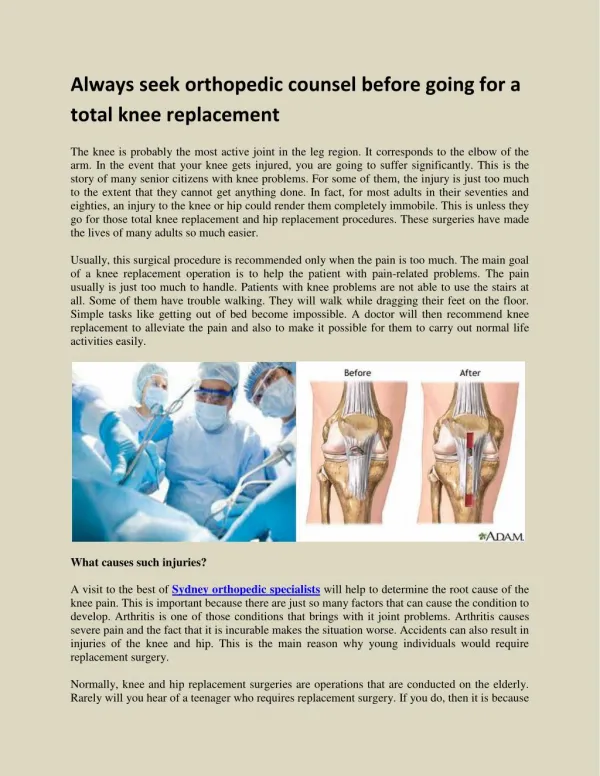 Always seek orthopedic counsel before going for a total knee replacement