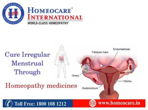 Homeopathy Treatment for PCOS | Homeocare International